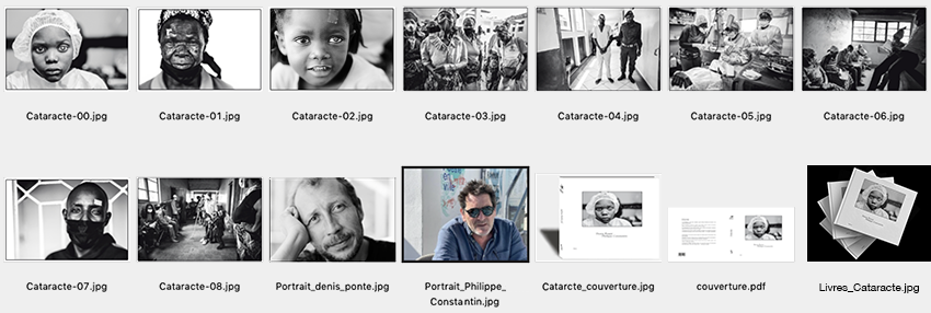 Cataracte, photographie denis pont&eacute;
